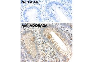 Immunohistochemistry (IHC) image for anti-Adenosine A2a Receptor (ADORA2A) (C-Term) antibody (ABIN7272985) (Adenosine A2a Receptor Antikörper  (C-Term))