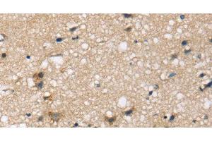 Immunohistochemistry of paraffin-embedded Human brain tissue using SEMA4A Polyclonal Antibody at dilution 1:45 (Sema4a Antikörper)