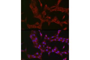 Immunofluorescence analysis of PC-12 cells using NKIR Rabbit pAb (ABIN7268903) at dilution of 1:100 (40x lens). (NKIRAS1 Antikörper  (AA 118-192))