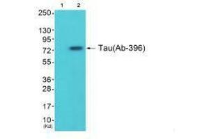 Western blot analysis of extracts from 293 cells (Lane 2), using Tau (Ab-396) antiobdy. (MAPT Antikörper  (Ser396))