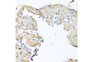 Immunohistochemistry of paraffin-embedded mouse heart using GPLD1 antibody at dilution of 1:100 (40x lens). (GPLD1 Antikörper)