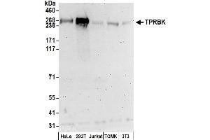 anti-Tetratricopeptide Repeat Domain 28 (TTC28) (AA 2450-2500) antibody
