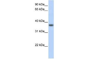 WB Suggested Anti-TMEM173 Antibody Titration:  0. (STING/TMEM173 Antikörper  (Middle Region))