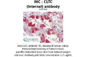 Image no. 2 for anti-Clathrin Heavy Chain (CLTC) (C-Term), (Internal Region) antibody (ABIN1733162) (Clathrin Heavy Chain (CLTC) (C-Term), (Internal Region) Antikörper)