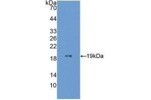 Detection of Recombinant ESM1, Human using Polyclonal Antibody to Endothelial Cell Specific Molecule 1 (ESM1)