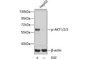 Western blot analysis of extracts HepG2 cells using Phospho-AKT1(Y315)/AKT2(Y316)/AKT3(Y312) Polyclonal Antibody. (AKT1 Antikörper  (pTyr312, pTyr315, pTyr316))