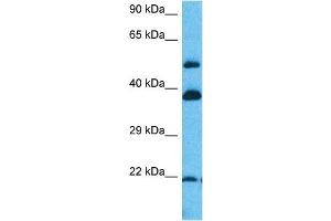 Host:  Rabbit  Target Name:  ERI1  Sample Tissue:  Human Lung Tumor lysates  Antibody Dilution:  1ug/ml (ERI1 Antikörper  (N-Term))