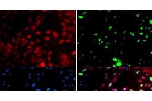 Immunofluorescence analysis of GFP-RNF168 transgenic U2OS cells using POLK Polyclonal Antibody (POLK Antikörper)