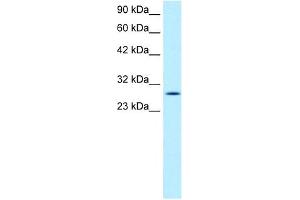 RGS16 antibody used at 1 ug/ml to detect target protein. (RGS16 Antikörper  (C-Term))