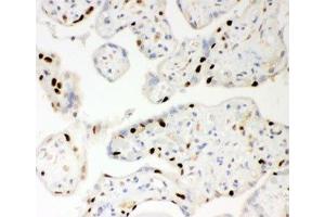 IHC-P: PARP antibody testing of human placenta tissue (PARP1 Antikörper  (AA 670-858))