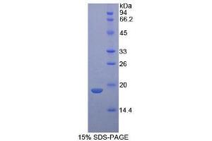 SDS-PAGE (SDS) image for Neurotensin (NTS) (AA 42-167) protein (His tag) (ABIN1879816)