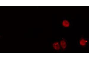 ABIN6274168 staining HeLa cells by IF/ICC. (MYF5 Antikörper  (N-Term))