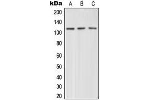 Western blot analysis of mGLUR4 expression in HeLa (A), mouse brain (B), rat brain (C) whole cell lysates. (Metabotropic Glutamate Receptor 4 Antikörper  (C-Term))