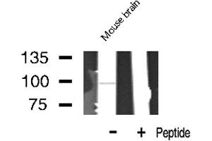 Western blot analysis of LTK expression in Mouse Brain lysate (LTK Antikörper  (Internal Region))