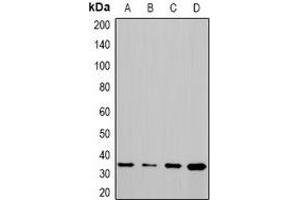Western blot analysis of CHIP expression in Hela (A), PC12 (B), COS7 (C), mouse liver (D) whole cell lysates. (STUB1 Antikörper)