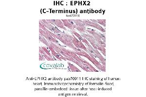 Image no. 1 for anti-Epoxide Hydrolase 2, Cytoplasmic (EPHX2) (C-Term) antibody (ABIN1734088) (EPHX2 Antikörper  (C-Term))