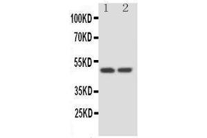 Anti-Kallistatin antibody, Western blotting Lane 1: HELA Cell Lysate Lane 2: SKOV Cell Lysate (SERPINA4 Antikörper  (C-Term))