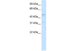 WB Suggested Anti-TCFAP2C Antibody Titration:  2. (TFAP2C Antikörper  (N-Term))