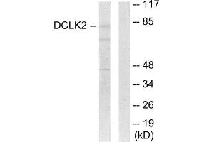 Western Blotting (WB) image for anti-Doublecortin-Like Kinase 2 (DCLK2) (N-Term) antibody (ABIN1849774) (DCLK2 Antikörper  (N-Term))