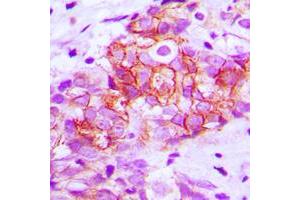 Immunohistochemistry (IHC) image for anti-Cadherin 1, Type 1, E-Cadherin (Epithelial) (CDH1) (C-Term) antibody (ABIN7295214)