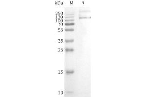 WB analysis of Human T-Nanodisc with anti-Flag monoclonal antibody at 1/5000 dilution, followed by Goat Anti-Rabbit IgG HRP at 1/5000 dilution (TRPV1 Protein)
