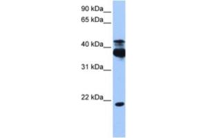 Western Blotting (WB) image for anti-serine/threonine Kinase 38 (STK38) antibody (ABIN2463209) (STK38 Antikörper)