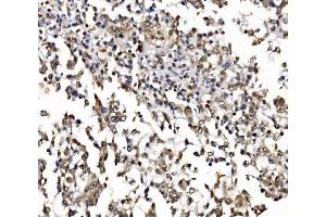IHC analysis of NOLA1/GAR1 using anti-NOLA1/GAR1 antibody (ABIN7602076). (GAR1 Antikörper  (AA 58-165))