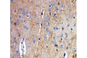 Used in DAB staining on fromalin fixed paraffin-embedded Brain tissue (Tachykinin 3 Antikörper  (AA 29-101))