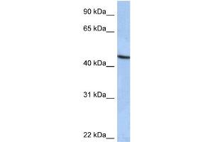 WB Suggested Anti-ZNF766 Antibody Titration:  0. (ZNF766 Antikörper  (C-Term))