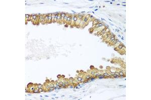 Immunohistochemistry of paraffin-embedded human prostate using LLGL2 antibody. (LLGL2 Antikörper)