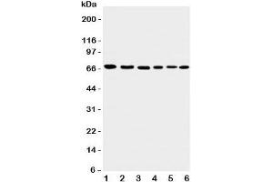 Western blot testing of Apoptosis-Inducing Factor antibody and Lane 1:  rat heart;  2: (r) brain;  3: human K562;  4: (h) HEPG2;  5: (h) A431;  6: mouse NIH3T3 cell lysate. (AIF Antikörper  (C-Term))