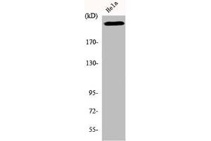 Western Blot analysis of HeLa cells using DNA-PKCS Polyclonal Antibody (PRKDC Antikörper  (C-Term))