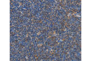 Immunohistochemistry (IHC) image for anti-Caspase Recruitment Domain Family, Member 6 (CARD6) antibody (ABIN2432767) (CARD6 Antikörper)