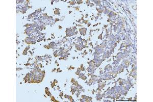 IHC analysis of ETFA using anti-ETFA antibody (ABIN7599281).