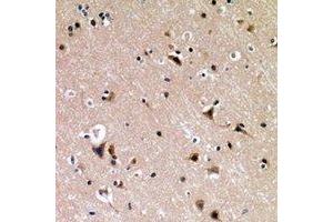 Immunohistochemical analysis of p53 (pS376) staining in human brain formalin fixed paraffin embedded tissue section. (p53 Antikörper  (C-Term, pSer376))