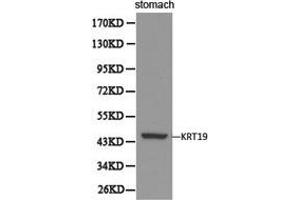 Western Blotting (WB) image for anti-Keratin 19 (KRT19) antibody (ABIN1873481) (Cytokeratin 19 Antikörper)