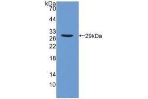 Detection of Recombinant iPLA2, Human using Polyclonal Antibody to Phospholipase A2, Calcium Independent (iPLA2) (PNPLA2 Antikörper  (AA 484-701))