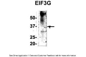 IP Suggested Anti-EIF3G Antibody Positive Control: NT2 CELL/BRAIN TISSUE