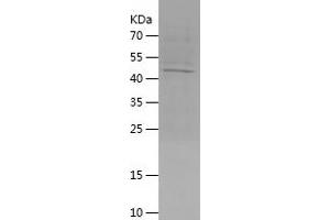 Western Blotting (WB) image for Aspartyl Aminopeptidase (DNPEP) (AA 1-219) protein (His-IF2DI Tag) (ABIN7121913) (Aspartyl Aminopeptidase Protein (DNPEP) (AA 1-219) (His-IF2DI Tag))