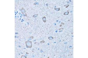 Immunohistochemistry of paraffin-embedded mouse spinal cord using NNMT antibody. (NNMT Antikörper  (AA 1-264))