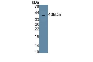 Detection of Recombinant MIP4a, Human using Polyclonal Antibody to Macrophage Inflammatory Protein 4 Alpha (MIP4a) (CCL26 Antikörper  (AA 24-94))