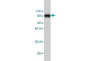 Western Blotting (WB) image for anti-Membrane Protein, Palmitoylated 3 (MAGUK P55 Subfamily Member 3) (MPP3) (AA 1-585) antibody (ABIN561844)