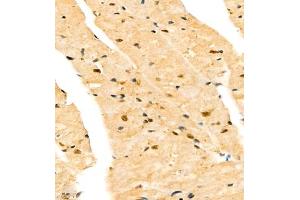 Immunohistochemistry (Paraffin-embedded Sections) (IHC (p)) image for anti-Cbp/p300-Interacting Transactivator, with Glu/Asp-Rich Carboxy-terminal Domain, 4 (CITED4) antibody (ABIN7073356)