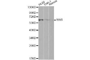 Western blot analysis of extracts of various cell lines, using WAS Antibody (ABIN1875343) at 1:1000 dilution. (WASP Antikörper)