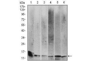 beta-2 Microglobulin Antikörper  (AA 21-100)