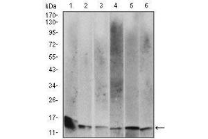 Western blot analysis using B2M mouse mAb against Hela (1), HEK293 (2), HepG2 (3),RAJI (4), A431 (5) and Jurkat (6) cell lysate.