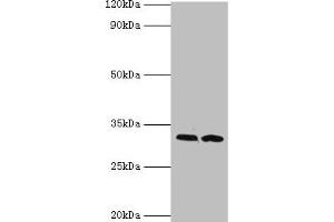 Western blot All lanes: RDM1 antibody at 4 μg/mL Lane 1: PC-3 whole cell lysate Lane 2: MCF-7 whole cell lysate Secondary Goat polyclonal to rabbit IgG at 1/10000 dilution Predicted band size: 32, 30, 16, 14, 29, 26, 9, 13, 19, 27 kDa Observed band size: 32 kDa (RDM1 Antikörper  (AA 125-284))