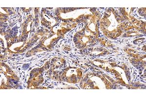 Immunohistochemistry (IHC) image for anti-Keratin 17 (KRT17) (AA 252-393) antibody (ABIN7434125)