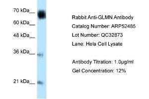 WB Suggested Anti-GLMN Antibody Titration: 0. (GLMN Antikörper  (C-Term))