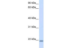 WB Suggested Anti-CNBP Antibody Titration:  0. (CNBP Antikörper  (N-Term))